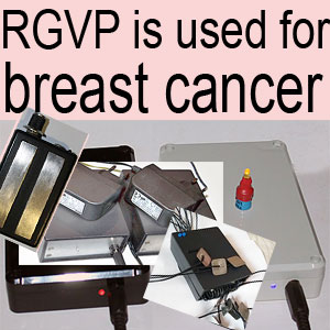 RGVP inhibits breast cancer.