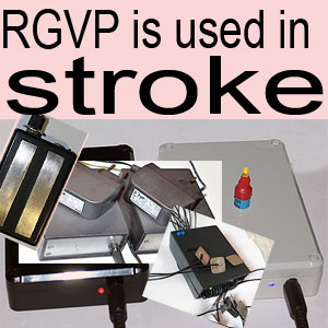 Strokes and the device RGVP.